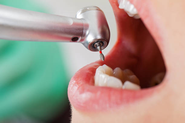 Best Emergency Treatment for Dental Infections or Abscesses in Gra Forks, ND